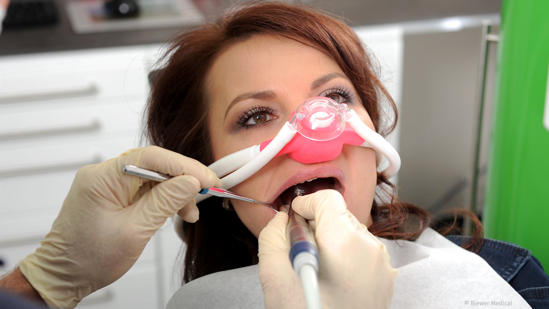 Lachgas-Sedierung: entspannte Zahnbehandlung für Angstpatienten